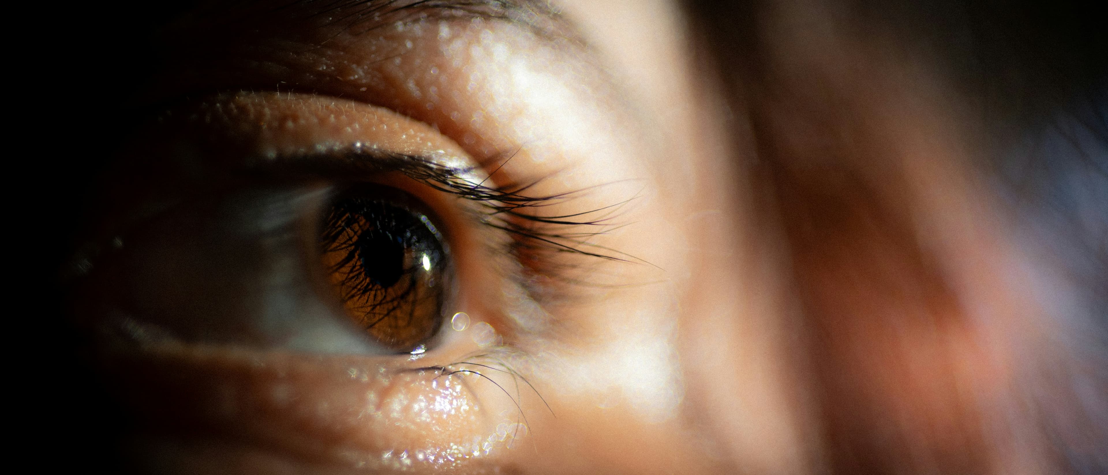 Eyelid Surgery Procedure